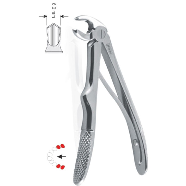 Extraction forceps children pattern fig. 6