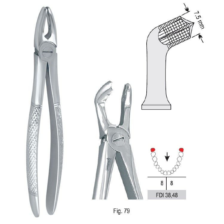 Extraction forceps European pattern fig. 79